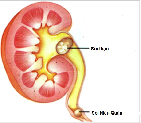 Những tác dụng tuyệt vời từ cây cối xay