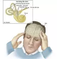 Bài thuốc chữa rối loạn tiền đình hiệu quả nhất