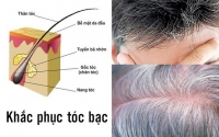 Những loại thảo dược chữa tóc bạc sớm